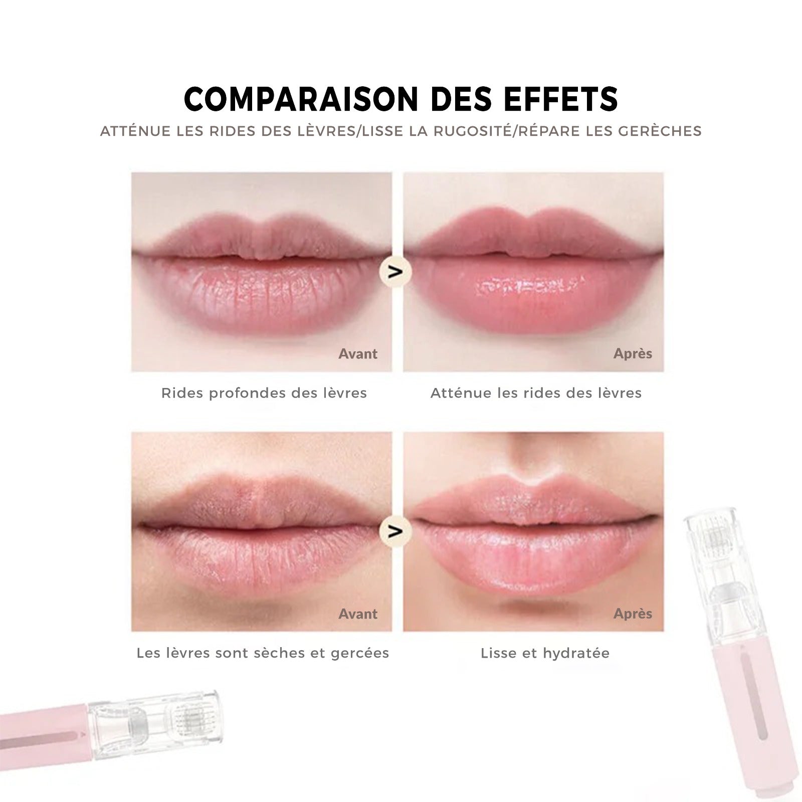 Derma Roller | LIPBOOST