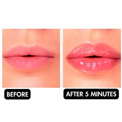 Derma Roller | LIPBOOST